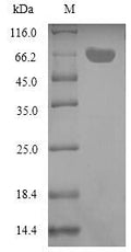 Recombinant Aeromonas salmonicida ADP-ribosyltransferase toxin AexT (aexT) – Figure 1 of 1