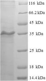 Recombinant Human Myosin regulatory light chain 2, skeletal muscle isoform (MYLPF) – Figure 1 of 1