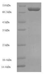 Recombinant Human Crossover junction endonuclease EME1 (EME1) – Figure 1 of 1