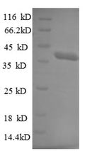 Recombinant Human E3 ubiquitin-protein ligase TRIM11 (TRIM11), partial – Figure 1 of 1