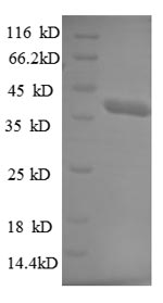 Recombinant Human E3 ubiquitin-protein ligase TRIM11 (TRIM11), partial – Figure 1 of 1