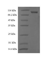 Recombinant Human Cytosolic non-specific dipeptidase (CNDP2) – Figure 1 of 1