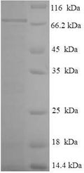 Recombinant Human Tektin-5 (TEKT5) – Figure 1 of 1