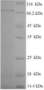 Recombinant Human Tektin-5 (TEKT5) – Figure 1 of 1