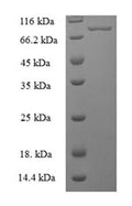 Recombinant Human Bifunctional polynucleotide phosphatase/kinase (PNKP) – Figure 1 of 1