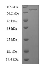 Recombinant Human Bifunctional polynucleotide phosphatase/kinase (PNKP) – Figure 1 of 1