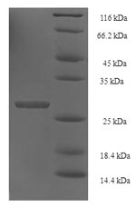 Recombinant Human Histone H2B type 1-N (HIST1H2BN) – Figure 1 of 1