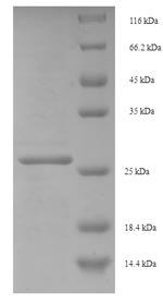 Recombinant Human C-Myc-binding protein (MYCBP) – Figure 1 of 1