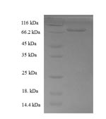 Recombinant Human Docking protein 1 (DOK1) – Figure 1 of 1