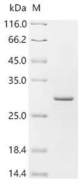 (Tris-Glycine gel) Discontinuous SDS-PAGE (reduced) with 5% enrichment gel and 15% separation gel.