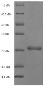 Recombinant Staphylococcus aureus Staphylococcal complement inhibitor (scn) – Figure 1 of 1