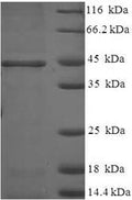 Recombinant Human 17-beta-hydroxysteroid dehydrogenase 14 (HSD17B14) – Figure 1 of 1