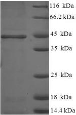Recombinant Human 17-beta-hydroxysteroid dehydrogenase 14 (HSD17B14) – Figure 1 of 1