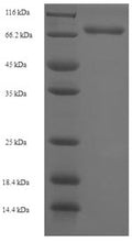Recombinant Human Diphthamide biosynthesis protein 2 (DPH2) – Figure 1 of 1