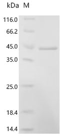 (Tris-Glycine gel) Discontinuous SDS-PAGE (reduced) with 5% enrichment gel and 15% separation gel.