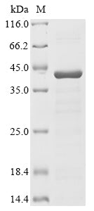 (Tris-Glycine gel) Discontinuous SDS-PAGE (reduced) with 5% enrichment gel and 15% separation gel.
