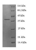 Recombinant Human C-C motif chemokine 19 (CCL19) – Figure 1 of 1