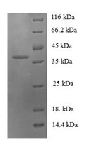 Recombinant Human C-C motif chemokine 19 (CCL19) – Figure 1 of 1