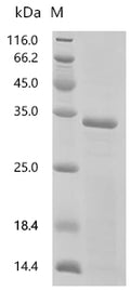 (Tris-Glycine gel) Discontinuous SDS-PAGE (reduced) with 5% enrichment gel and 15% separation gel.