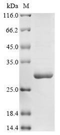 (Tris-Glycine gel) Discontinuous SDS-PAGE (reduced) with 5% enrichment gel and 15% separation gel.