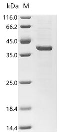 (Tris-Glycine gel) Discontinuous SDS-PAGE (reduced) with 5% enrichment gel and 15% separation gel.