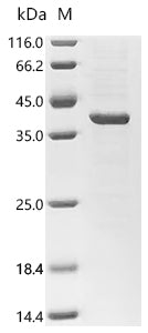 (Tris-Glycine gel) Discontinuous SDS-PAGE (reduced) with 5% enrichment gel and 15% separation gel.
