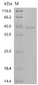 (Tris-Glycine gel) Discontinuous SDS-PAGE (reduced) with 5% enrichment gel and 15% separation gel.