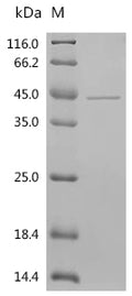 (Tris-Glycine gel) Discontinuous SDS-PAGE (reduced) with 5% enrichment gel and 15% separation gel.