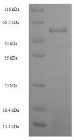 Recombinant Human Methionine synthase (MTR), partial – Figure 1 of 1
