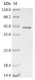 (Tris-Glycine gel) Discontinuous SDS-PAGE (reduced) with 5% enrichment gel and 15% separation gel.