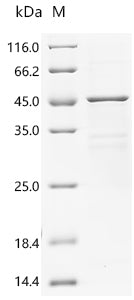 (Tris-Glycine gel) Discontinuous SDS-PAGE (reduced) with 5% enrichment gel and 15% separation gel.