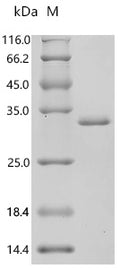 (Tris-Glycine gel) Discontinuous SDS-PAGE (reduced) with 5% enrichment gel and 15% separation gel.