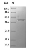 Recombinant Human 3-hydroxyacyl-CoA dehydrogenase type-2 (HSD17B10) – Figure 1 of 1