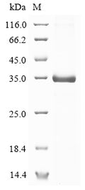 (Tris-Glycine gel) Discontinuous SDS-PAGE (reduced) with 5% enrichment gel and 15% separation gel.