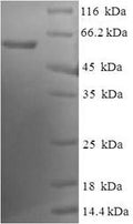 Recombinant Human Endoplasmic reticulum resident protein 44 (ERP44) – Figure 1 of 1