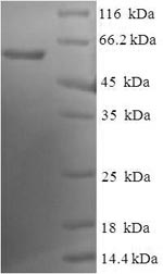 Recombinant Human Endoplasmic reticulum resident protein 44 (ERP44) – Figure 1 of 1