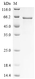 Recombinant Human MAP kinase-interacting serine/threonine-protein kinase 1 (MKNK1) – Figure 1 of 1