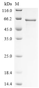 Recombinant Human MAP kinase-interacting serine/threonine-protein kinase 1 (MKNK1) – Figure 1 of 1