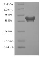 Recombinant Human Programmed cell death protein 10 (PDCD10) – Figure 1 of 1