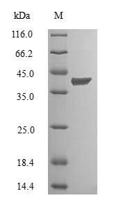 Recombinant Human Cyclin-dependent kinase 2-interacting protein (CINP) – Figure 1 of 1