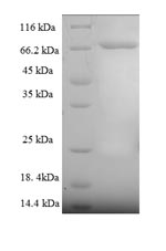 Recombinant Human Cytoplasmic polyadenylation element-binding protein 1 (CPEB1) – Figure 1 of 1