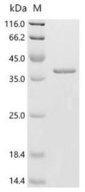 (Tris-Glycine gel) Discontinuous SDS-PAGE (reduced) with 5% enrichment gel and 15% separation gel.