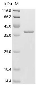 (Tris-Glycine gel) Discontinuous SDS-PAGE (reduced) with 5% enrichment gel and 15% separation gel.