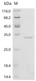 (Tris-Glycine gel) Discontinuous SDS-PAGE (reduced) with 5% enrichment gel and 15% separation gel.