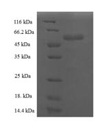 Recombinant Arabidopsis thaliana Trihelix transcription factor GT-1 (GT-1) – Figure 1 of 1