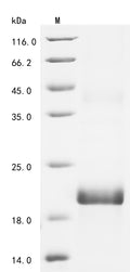 (Tris-Glycine gel) Discontinuous SDS-PAGE (reduced) with 5% enrichment gel and 15% separation gel.