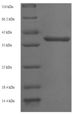 Recombinant Human Gem-associated protein 7 (GEMIN7) – Figure 1 of 1