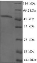 Recombinant Human AKT-interacting protein (AKTIP) – Figure 1 of 1