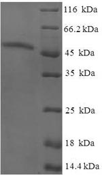 Recombinant Human AKT-interacting protein (AKTIP) – Figure 1 of 1