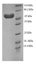 Recombinant Human Plexin-A4 (PLXNA4), partial – Figure 1 of 1